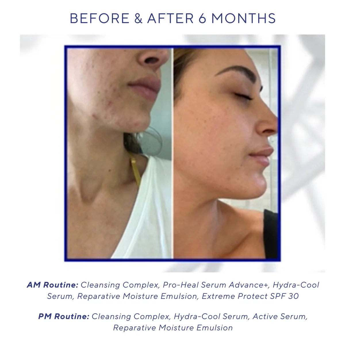 Pro heal serum advance