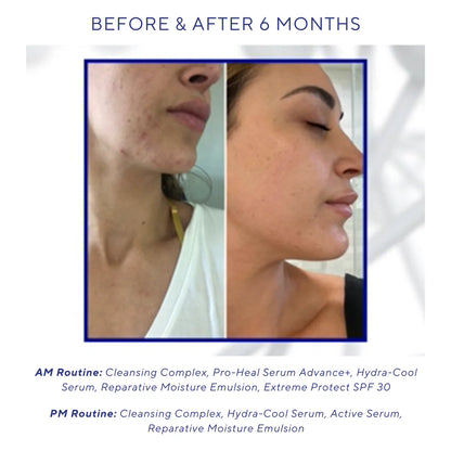 Pro heal serum advance